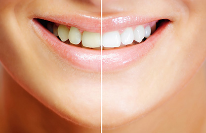 城南区南片江・おかもと歯科こども歯科クリニック